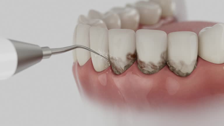 Reliable Dental contractor in Molalla, OR by Smile Center Dentistry